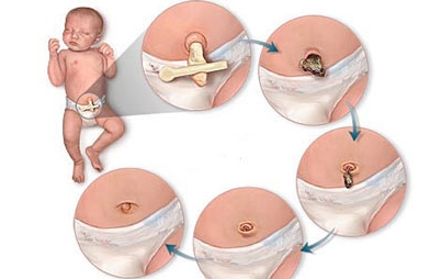 bebeğin göbeği ve bebeklerde göbek bakımı